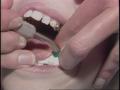 Video: [News Clip: Kids dental]
