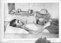Photograph: [Young man lying in a hospital bed, dying of starvation]